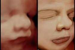 Prenatal Premiere Ultrasound