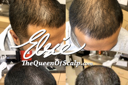 SMP Hair Clinic The Queen Of Scalp